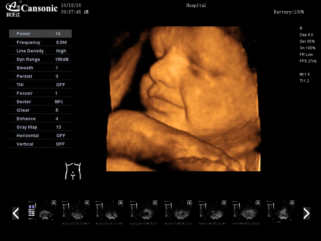 4D Color Doppler Sonograph K10