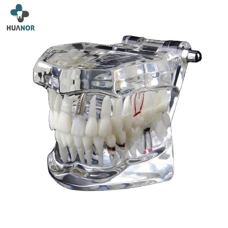 Dentista médico modelo de Anatomia Dental Modelo Dente estudo 32 dentes Modelo com Base