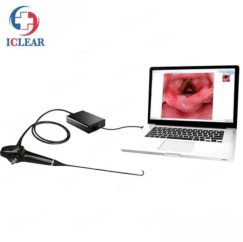 USB Endoscope USB Flexible Video Rhinolaryngoscope