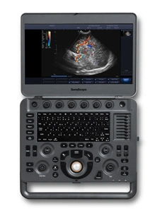 Color Doppler Sonoscape X5 for Pregnancy with Probe