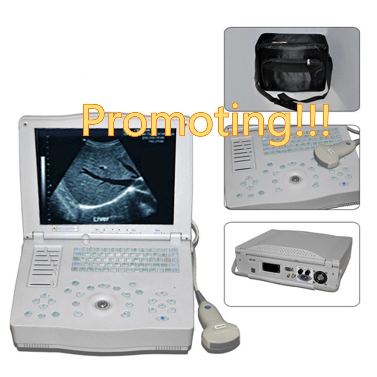 2015 Top Selling Full Digital Ultrasound Scanner PT3000e1