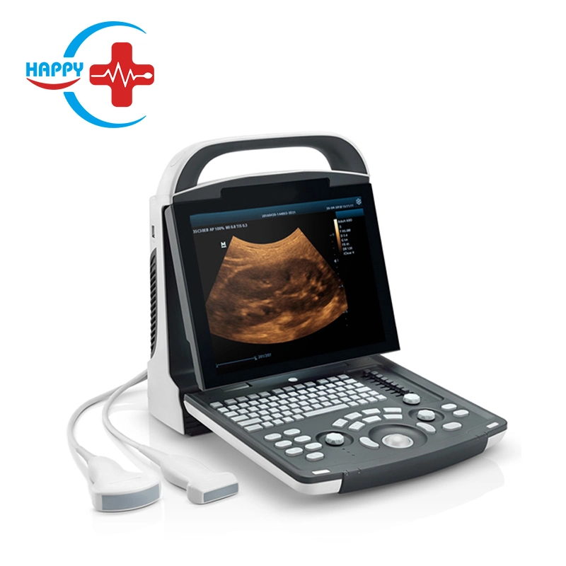 Dp-10 Hospital Medical Equipment Ultrasound Machine Scanner Mindray Portable Full Digital Ultrasound with LED Display