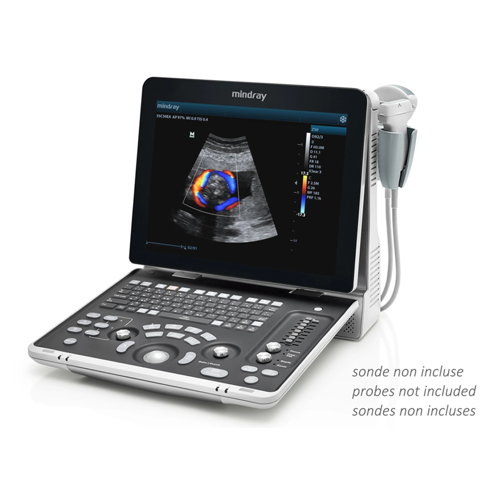 Hot Sales Mindray Z50 Color Doppler Ultrasound Diagnosis Ultrasound For Hospital Clinic