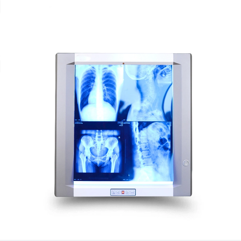 LCD X Ray Film Viewer X Ray Lightbox Radiography Film Viewer