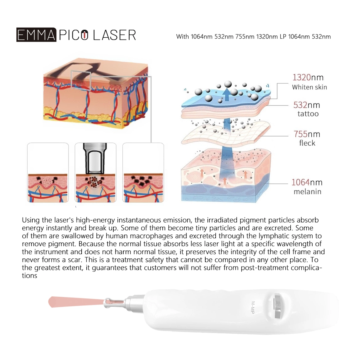 High quality/High cost performance  Portable 532/1064/1320nm Pico Laser Machine Pigment Tattoo Removal Machine