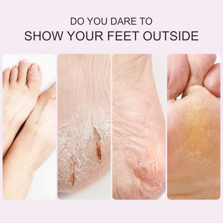 Dead Skin Scrub Socks Soft Foot Mask