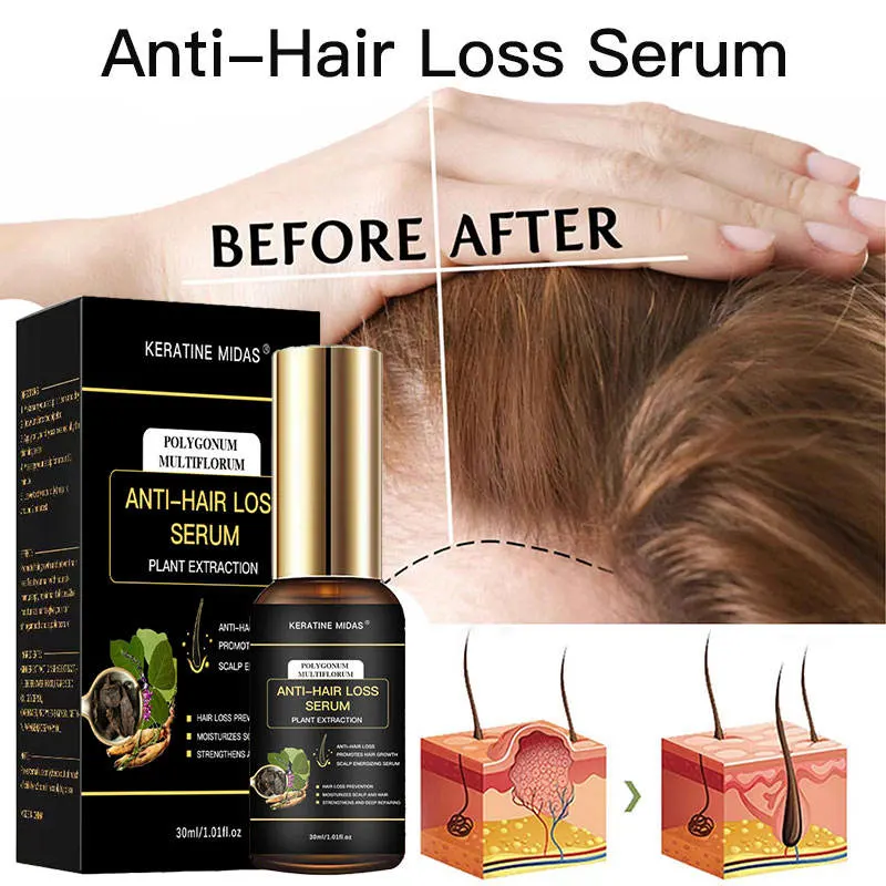 Hair Treatment Anti Hair Loss Products Natural Organic Ginger Regrowth Hair Thickening