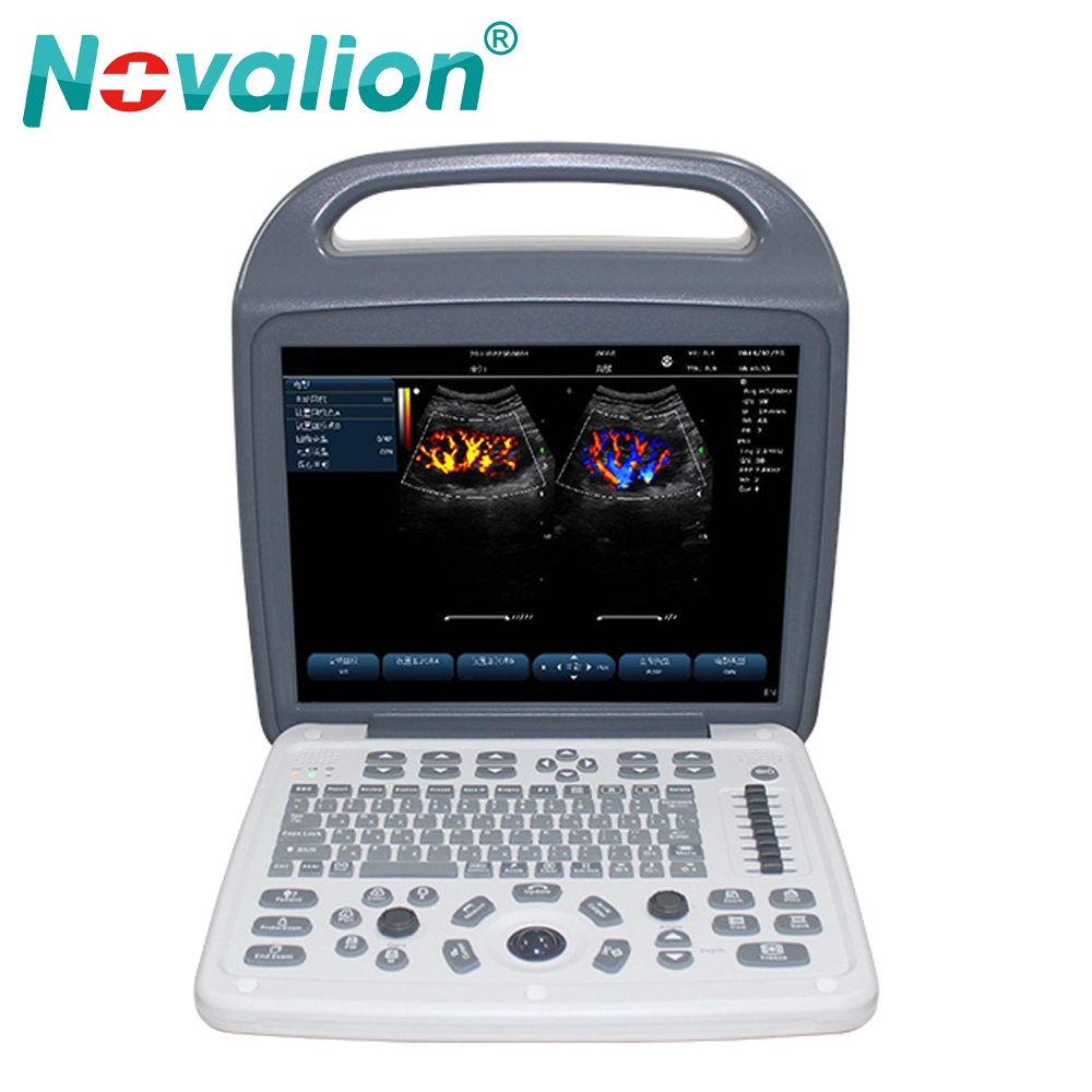 Factory Wholesale Price Imaging Abdominal Ob Gyn Small Organ Urology Vascular Cardiac Color Doppler Portable Ultrasound