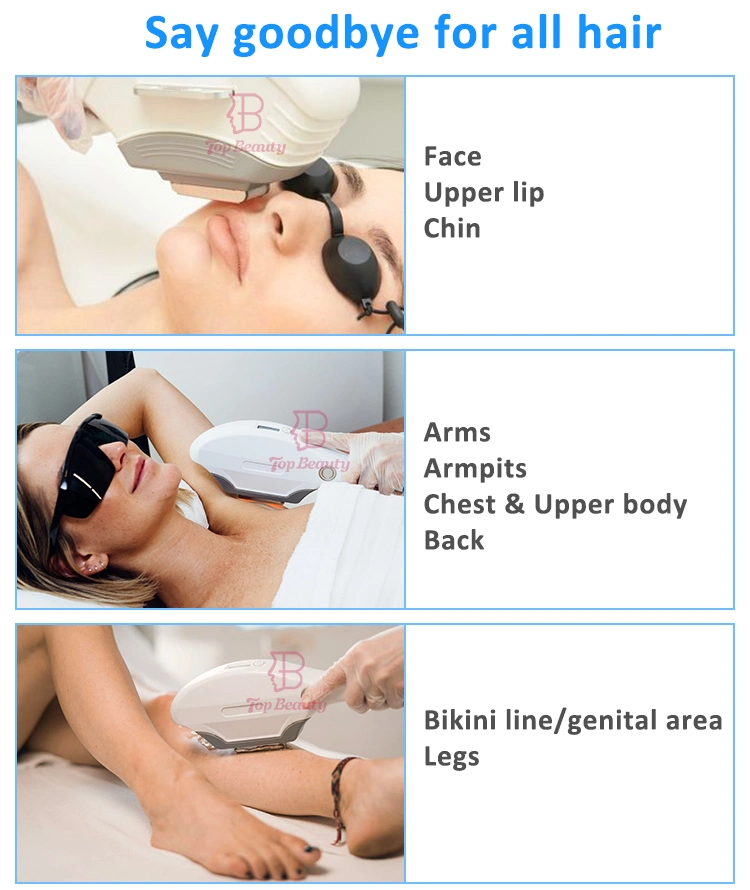 OEM IPL Photorejuvenation Opt Elight Skin Photo Rejuvenation Ice Laser Hair Removal Therapy Elight Opt IPL Hair Removal Machine