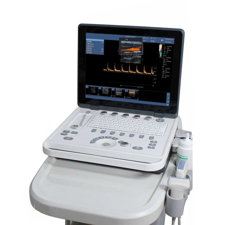 Maq5V Medical Vet 4D Color Doppler ultra-som portátil Scannere a máquina