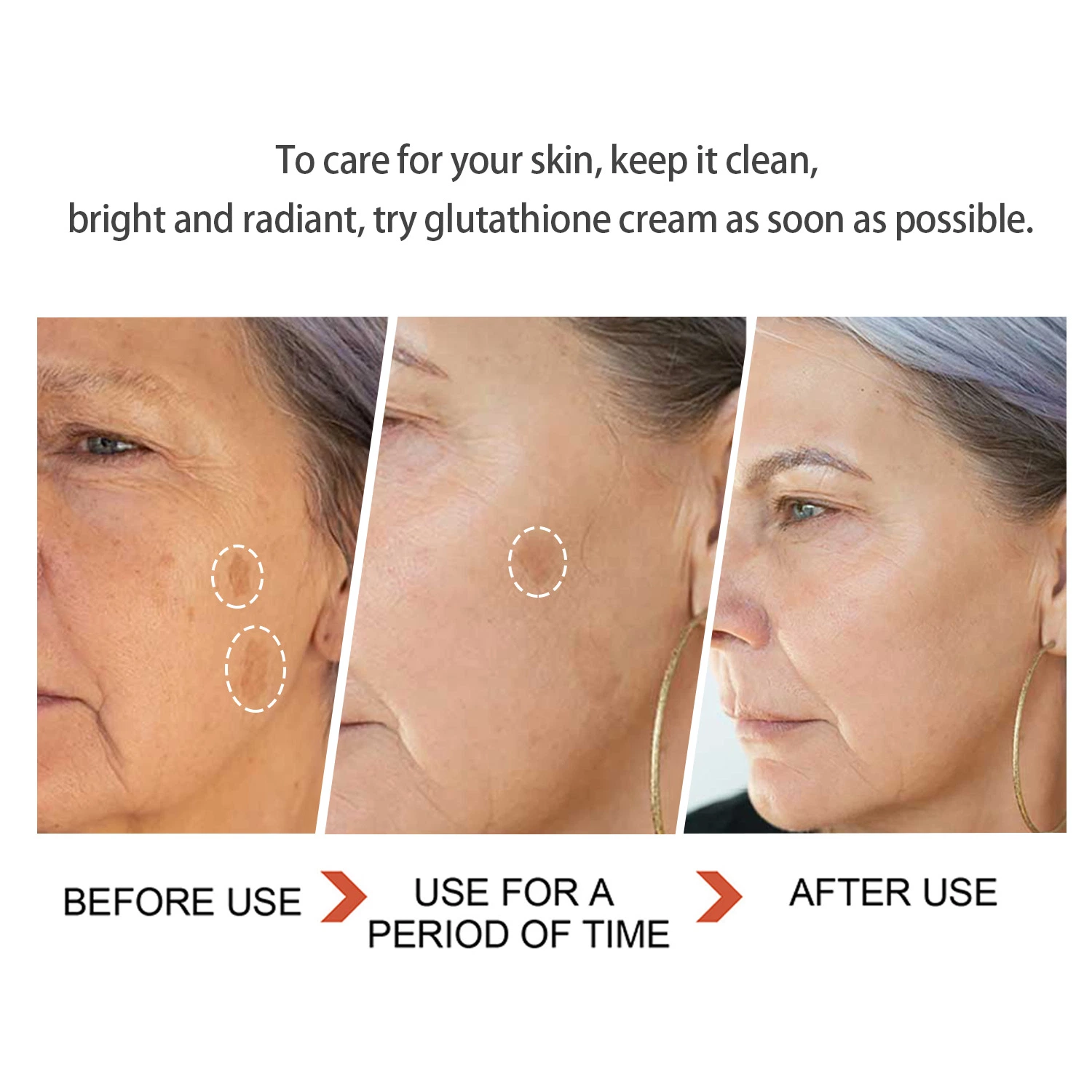 Beauty Cosmetics Skin Care Dark Spot Remover Cream Glutathione Cream Skin Whitening