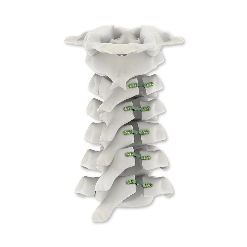 Горячая печать с логотипом Titanium Youbetter China Medical Consumable Spine Фиксациор Ортопедический