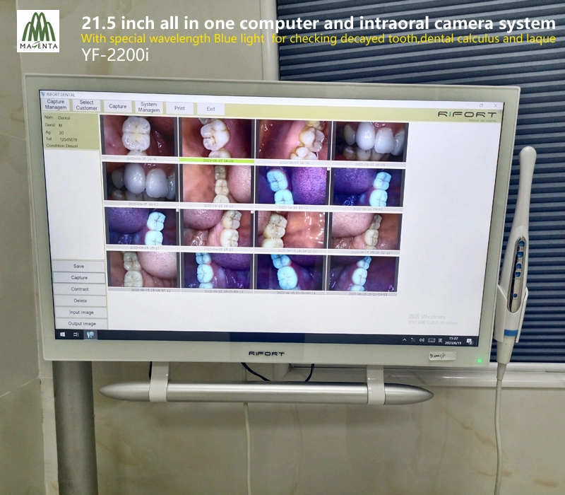 Configuração de alta 21,5" de tela sensível ao toque Windows 10 e Oral Dentária Unidade de câmara com luz azul para dentes cariados/cálculo matemático e placas