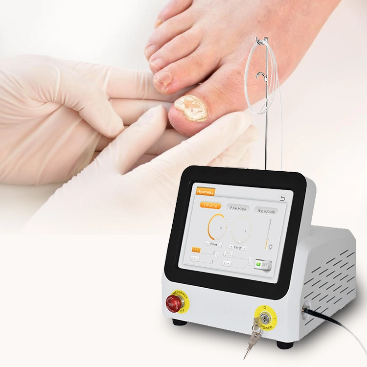980nm Diode Laser for Portable Nail Fungus Onychomycosi Most Effective Podiatry Equipment