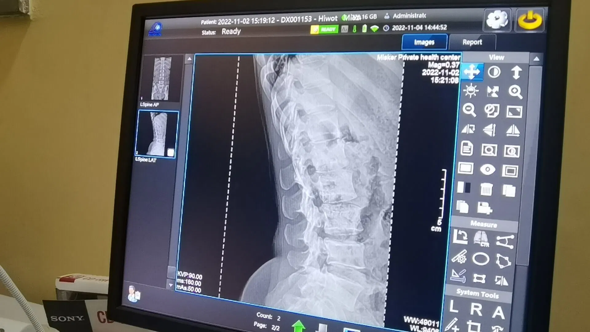 Doble sistema de radiografía de columna