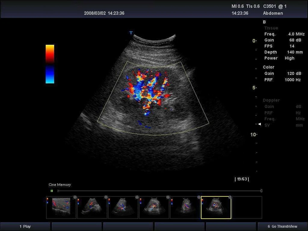 Ultrasonido Doppler Color de alta calidad el equipo de diagnóstico