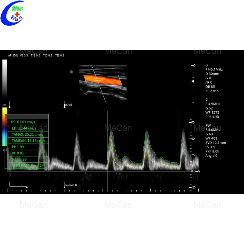 Hot Sale Animal System Veterinary Handheld Device Price Ultrasound Machine with CE Mci0581