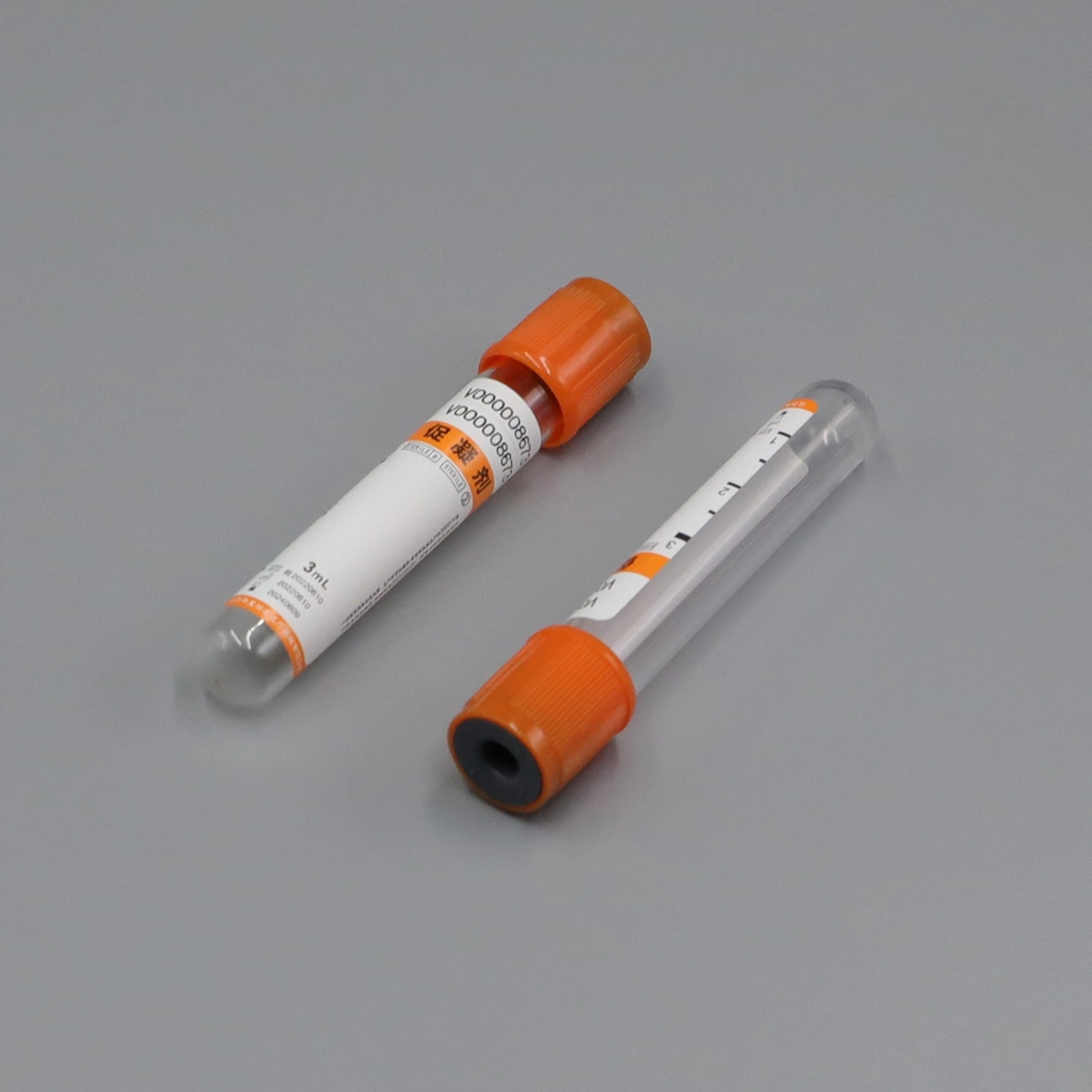 2ml~10ml 7ml 10ml Wholesale/Supplier Medical Supply Glue Removal Separator Vacuum Blood Vessel