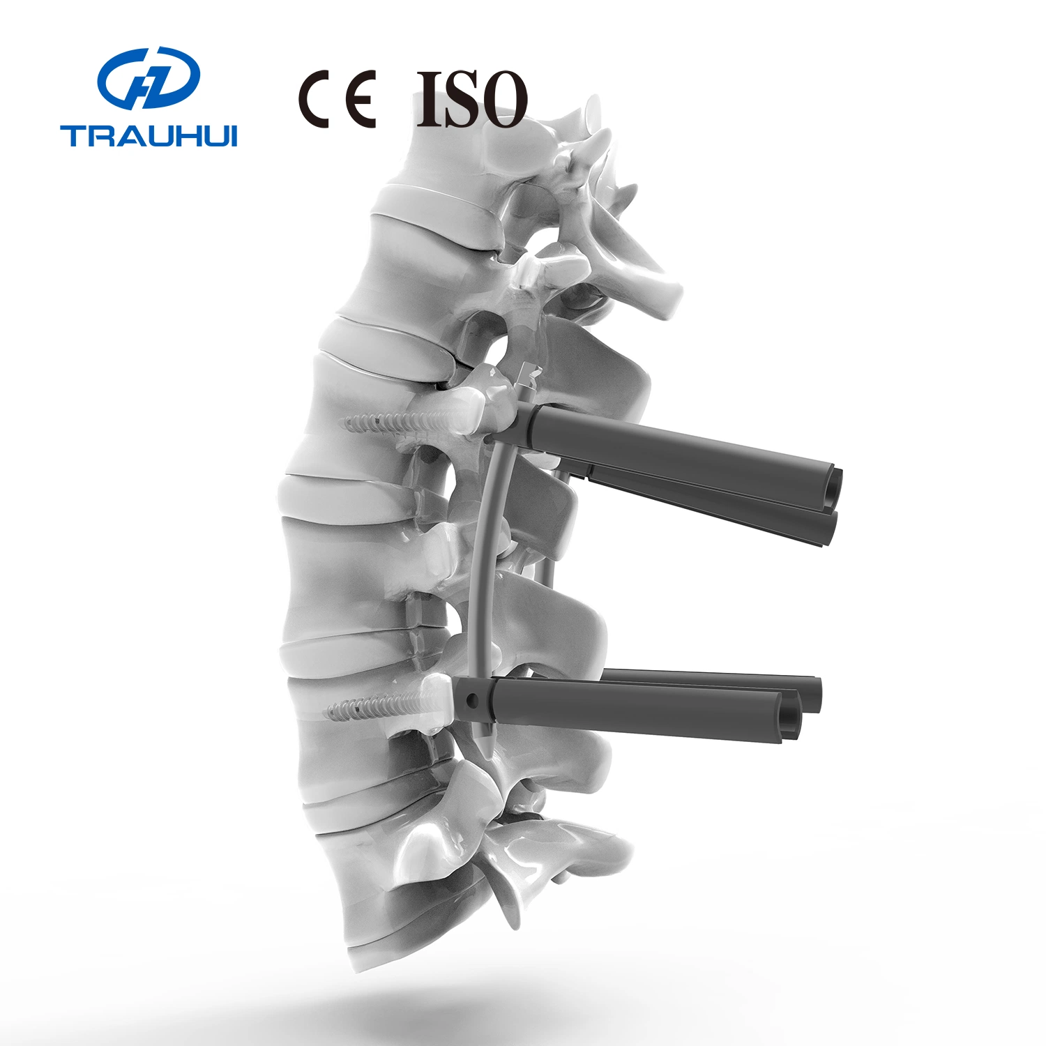 Conjunto de instrumentos de fijación cervical posterior