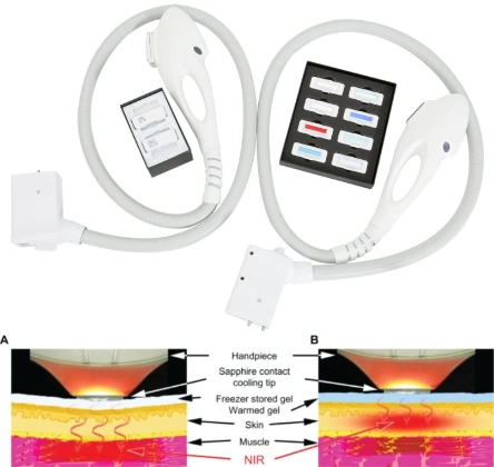 2023 luz profissional de células FPL NIR IPL depilação intensa Equipamento de cabeleireiro de rejuvenescimento da pele com luz de impulso