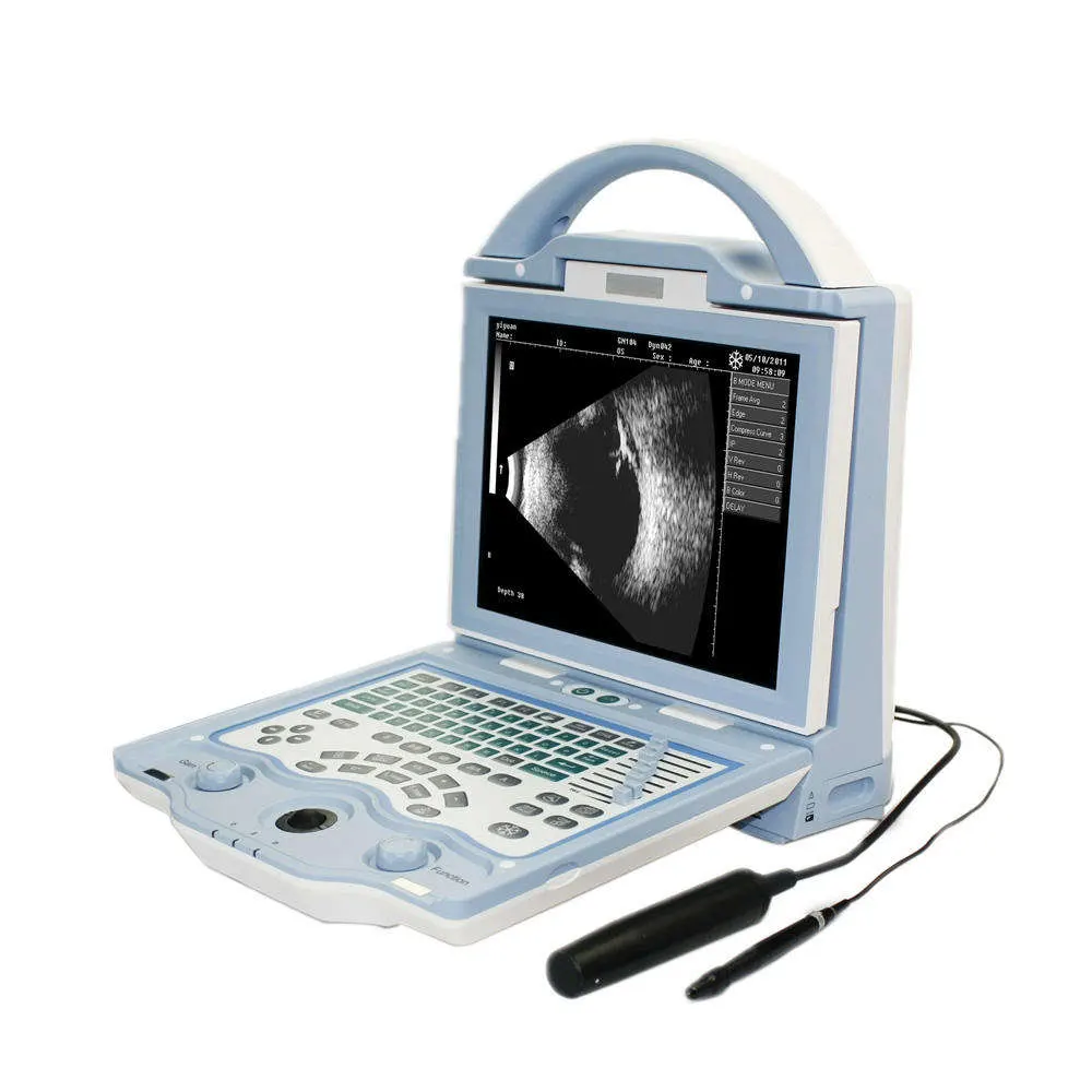 LCD-Bildschirm Augenschallsystem A/B Scan Machine Augenschallsystem für Ophthalmolog