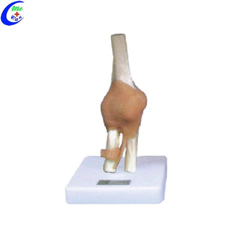 Shoulder Joint Model with Ligaments for Teaching