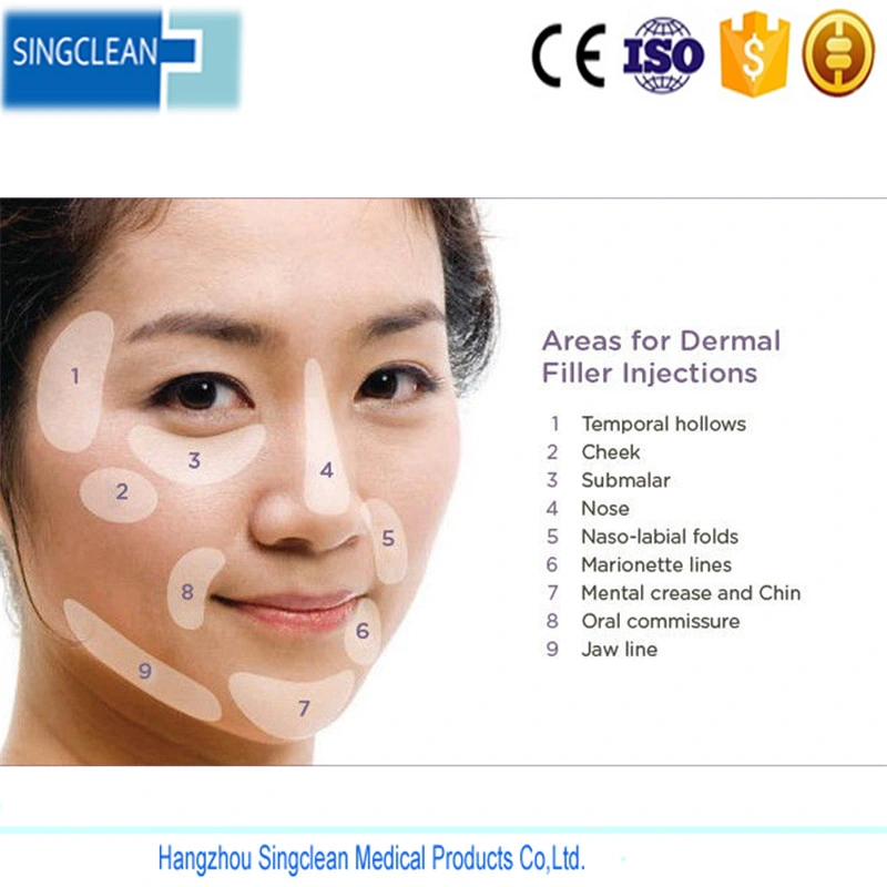 Singderm Cheek/Lip/Nose Filler Enhancement Cross-Linked Ha Derma Filler 0.3% Lidoc with CE