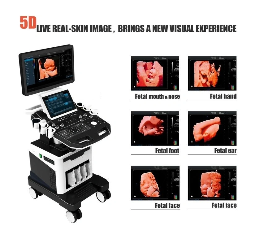 Vascular Orthopedics Full Digital Trolley 4D 5D Doppler Color Ultrasound Scanner Machine