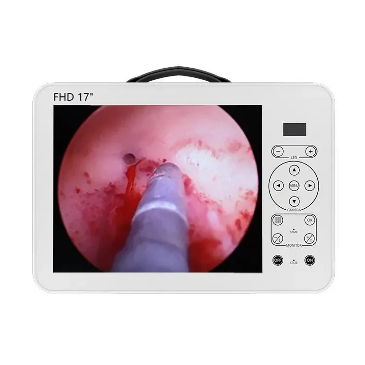 Ltes53 New Model Endoscopic Camera Adaptor Medical Imaging Equipment Portable Endoscopy Camera System