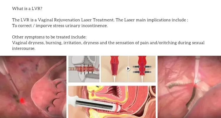 Médico 980 1470 Diodo Laser para Cirurgia laparoscópica, rejuvenescimento vaginal, Laser cirúrgico aparelho vaginal aperto vaginal