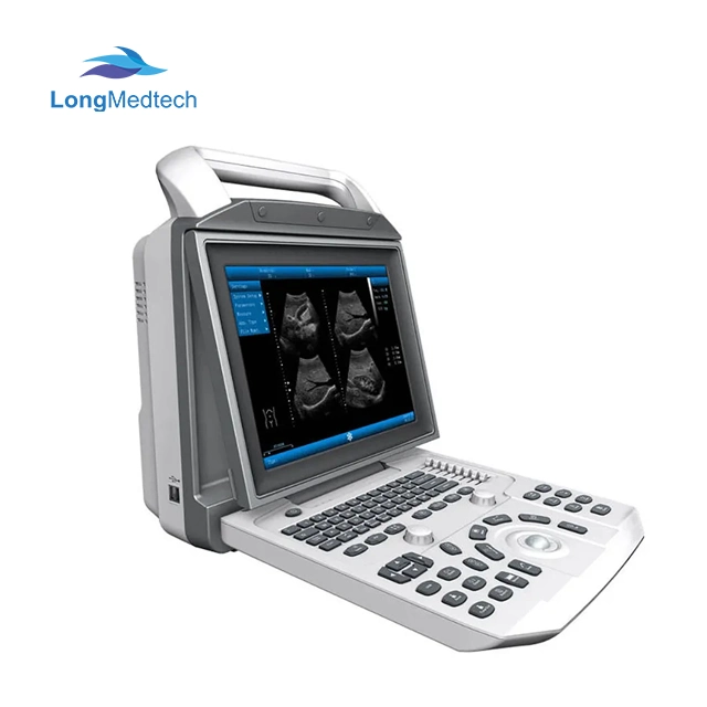 Tragbares medizinisches Farbdoppler-Ultraschallsystem Zoncare i50 System 3D 4D Farbdoppler Laptop Ultraschall