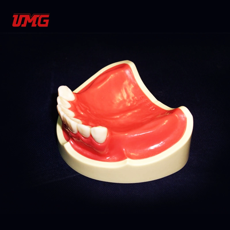 New Dental Educational Model Teeth Missing Model