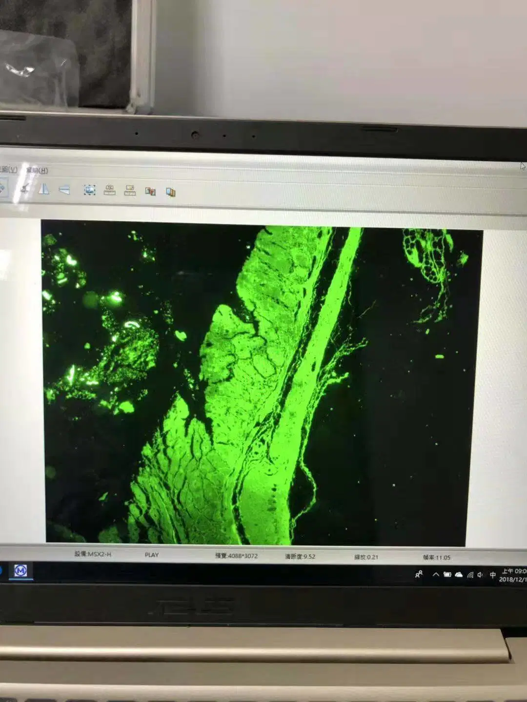 DAPI/FITC/Cy3/Cy5 Fuente de luz LED para microscopía de fluorescencia