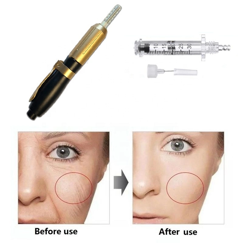 2 in 1 0.3ml&0.5ml Systems High Pressure Hyaluronic Acid Lip Filler Pen Needle Free Injection Gun