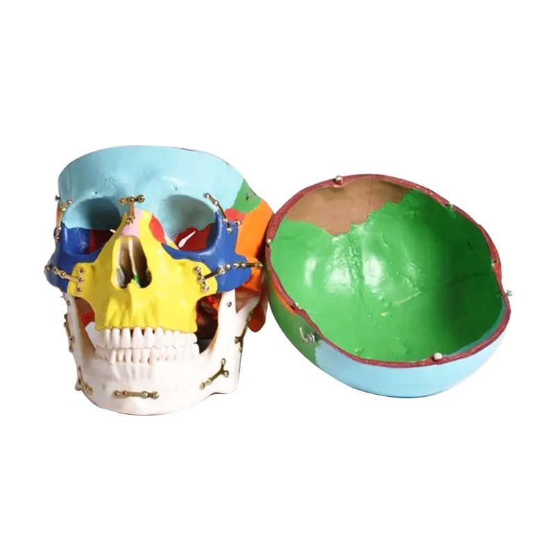 Colorful Skull Model Anatomical with Titanium Plate for Medical Training