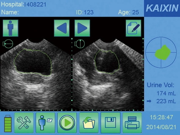 Chinese Factory Supply Noninvasively Urine Scanner Bladder Volume Tester