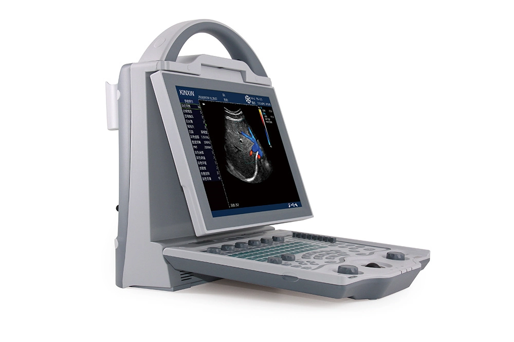 Portable Design Economic End Color Doppler Ultrasound Scanner