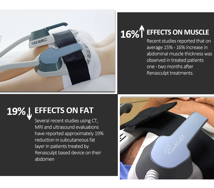 2021 Renasculpt 10 Tesla EMS 4 asas pérdida de peso adelgazar EMS Neo EMS escultura corporal de la máquina de escultura