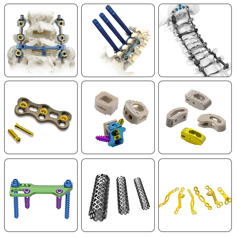 المنتجات الطبية جراحة العظام 6.0مم نظام برغي تثبيت العمود الفقري