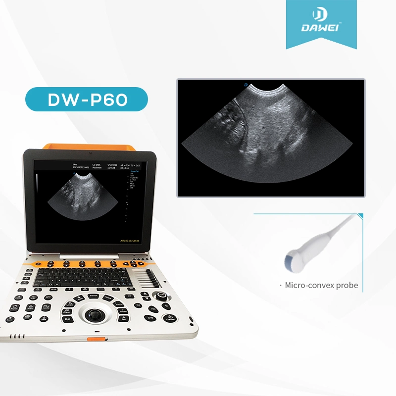 Portable Imaging Machines Dwp6 CE Approved Color Doppler Ultrasound System