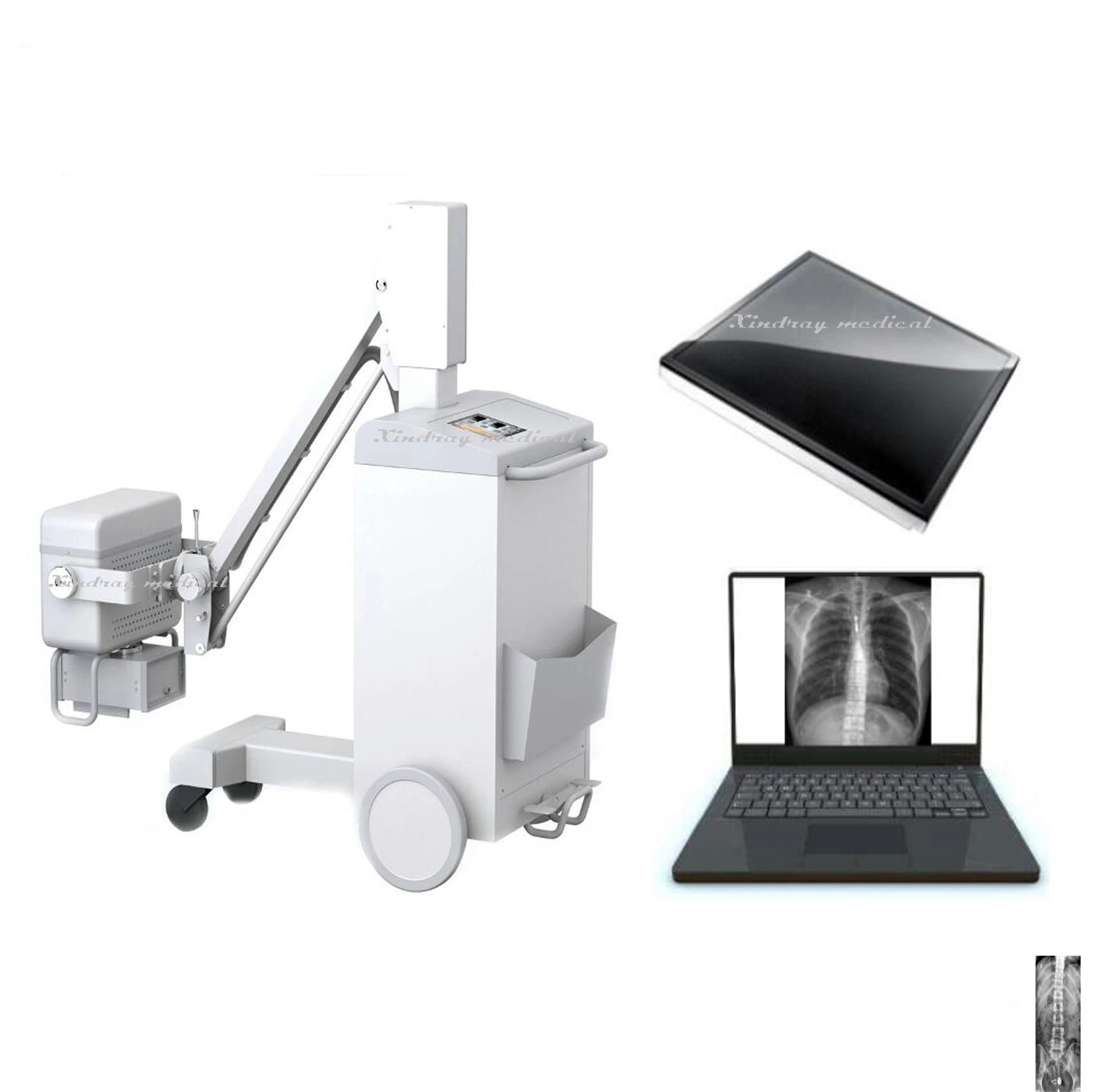 Mobile X-ray Machine Adjustable Parameter with High Frequency for Diagnosis Patient