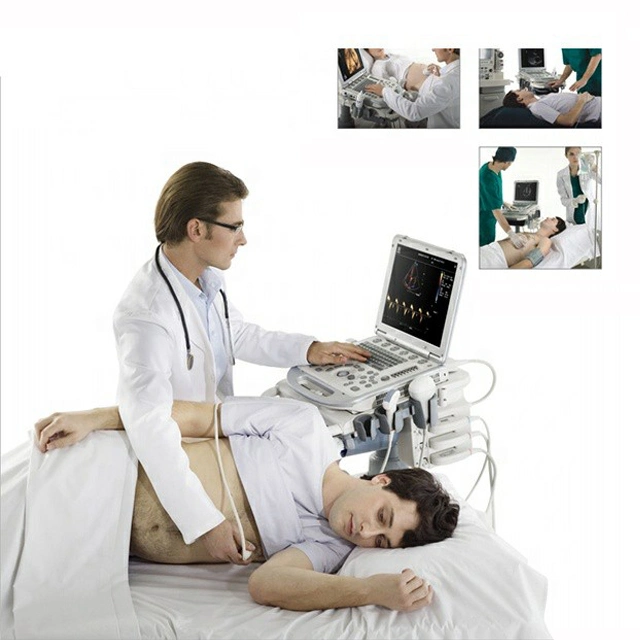 Mindray M7 Laptop Color Doppler Ultrasound