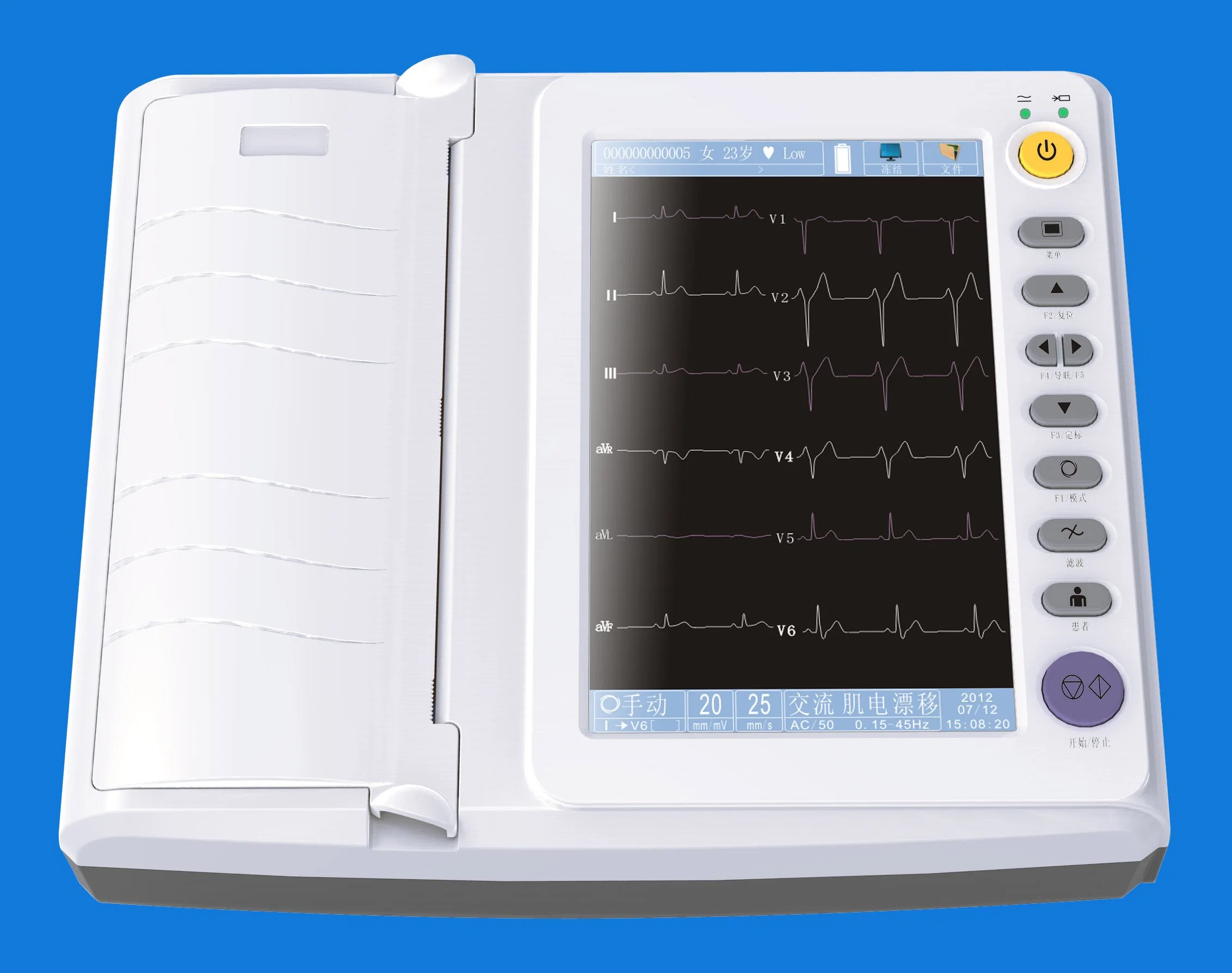 Máquina de ECG de 3 canales con aprobación CE/ISO para hospital (EKG03A)