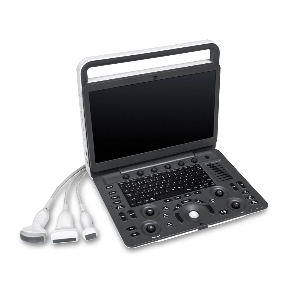 Portable Sonoscape E2 Full Digital Color Doppler Ultrasound Diagnosis System