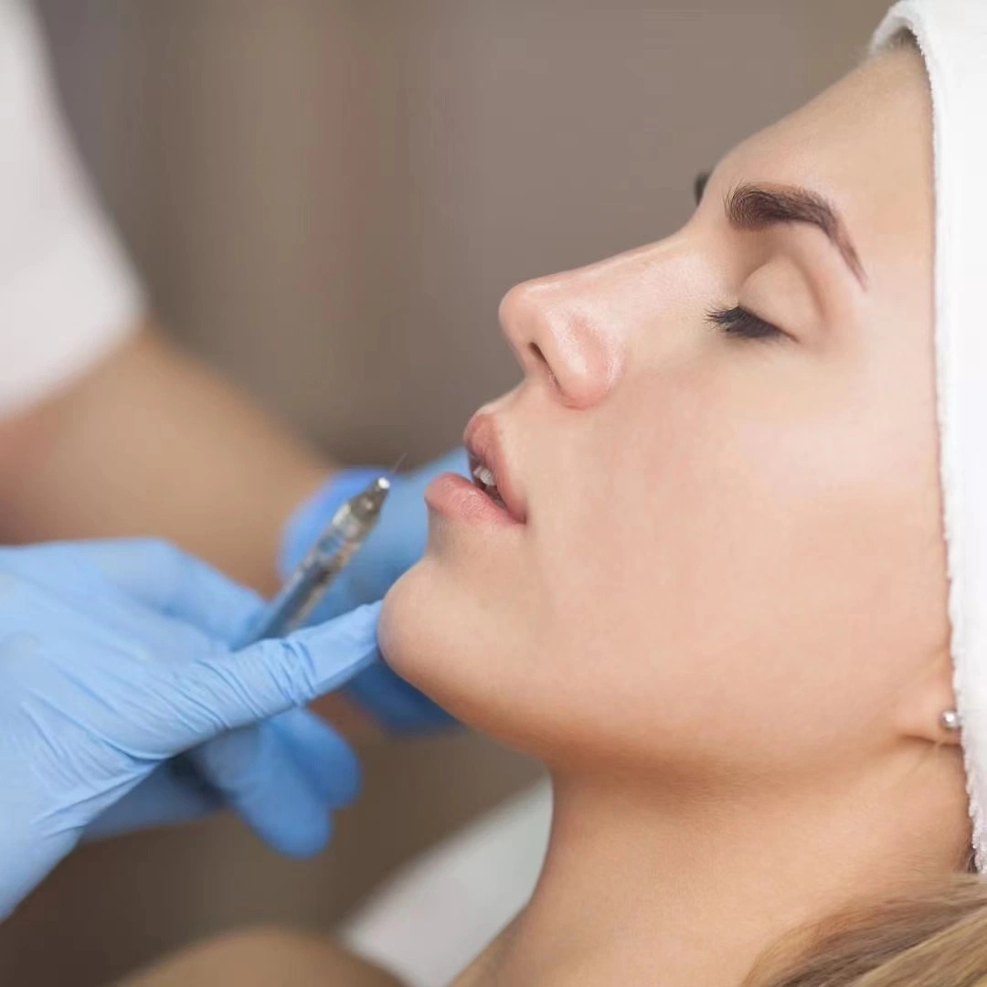 Hyaluronsäure Gel Injectable Dermal Filler für die Gesichtspflege