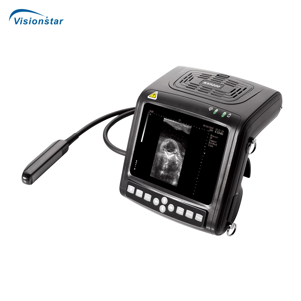 KX-5200 volldigitaler B-Mode-Ultraschallscanner (Veterinär)