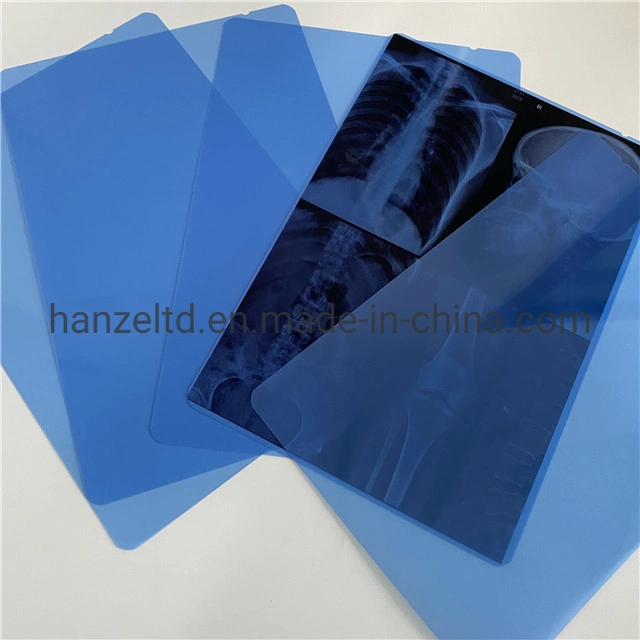 Degital Blue Color Inkjet Pet Film for Medical X Ray Equipment High Quality