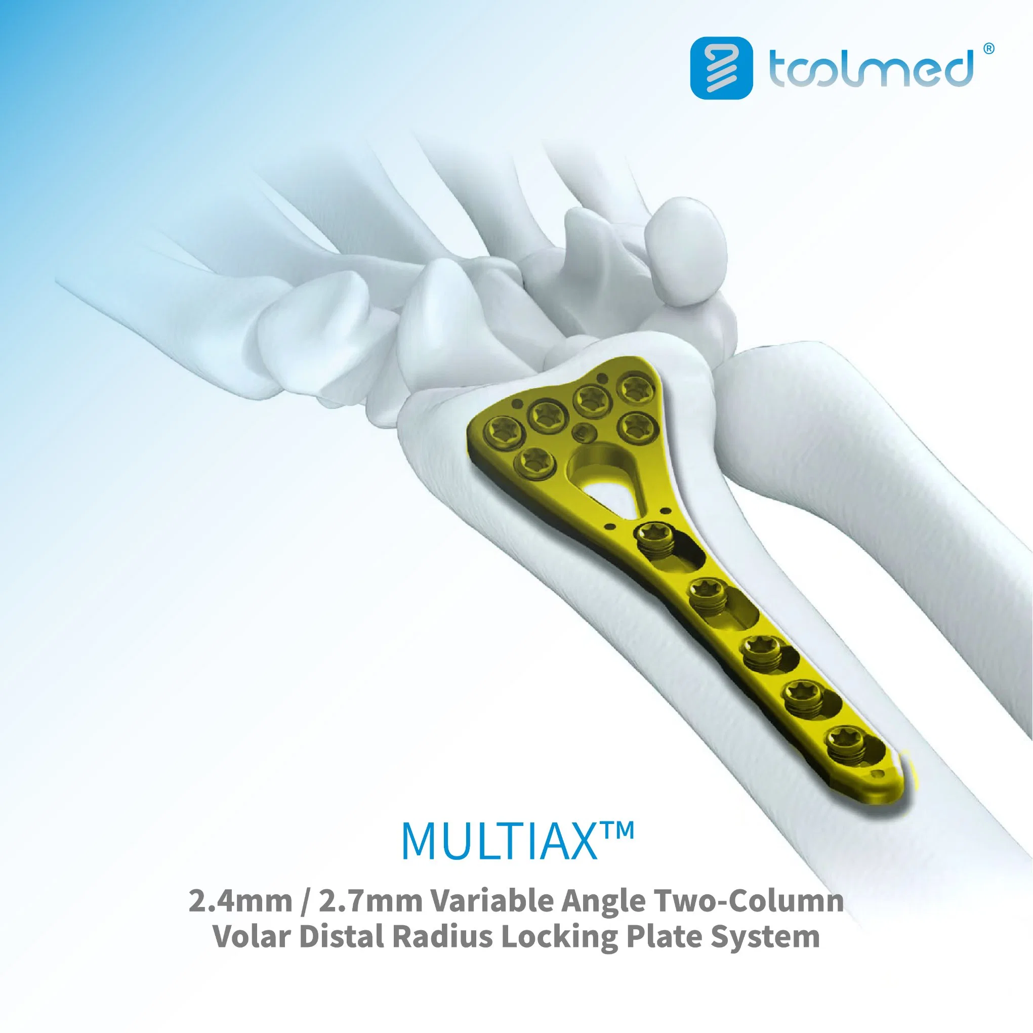 Multiax Variable Angle Two-Column Volar Distal Radius Locking Compression Bone Plate, Va LCP System, Titanium Orthopedic Surgical Implant for Trauma Surgery