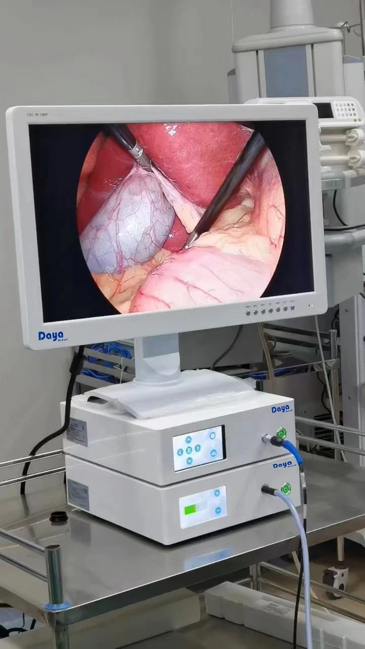 Equipamento médico Vet Digital Portátil endoscópico/endoscópio de vídeo HD Câmara