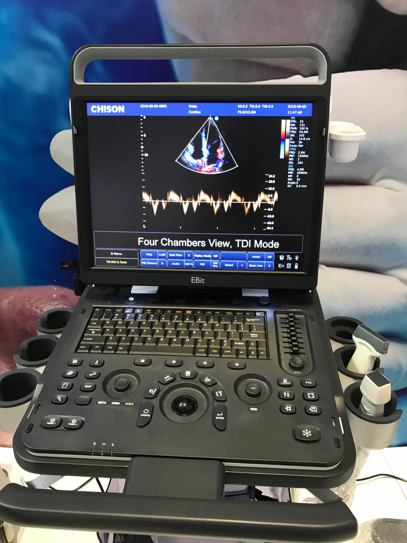 Chiosn Ebit 60 Ecografo Portable Color Doppler System for Ob/Gyn, Urology, Cardiac, Rectum, Pediatric, Orthopedic Ebit50 Ebit60